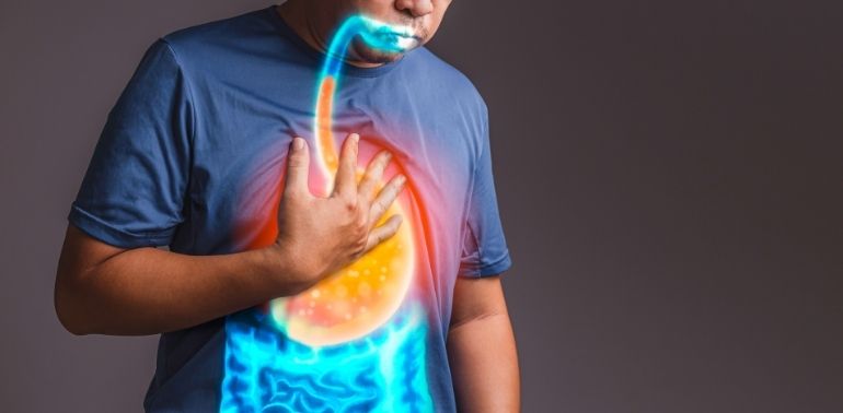 Gastro-esophageal Reflux Disease (GERD)